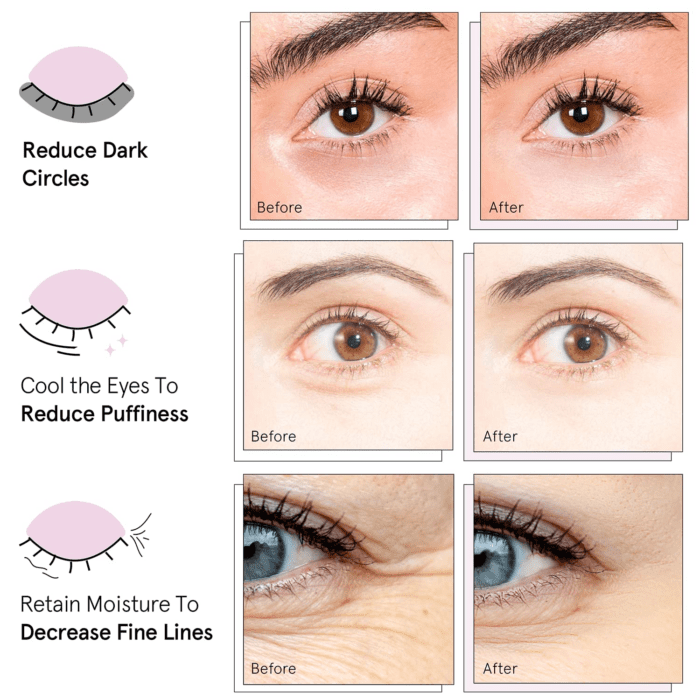 Award Winning under Eye Mask - Valentines Gifts - Gifts for Mom - Reduce Dark Circles, Puffy Eyes, Undereye Bags, Wrinkles - under Eye Patches - Vegan Self Care (24 Pairs, Pink) - Image 3